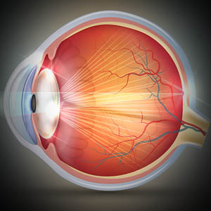 Cataracts,  Read +